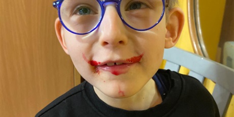 Powiększ grafikę: Zbliżenie na uśmiechniętego chłopca, którewgo buzia jest wybrudzona buraczkiem.